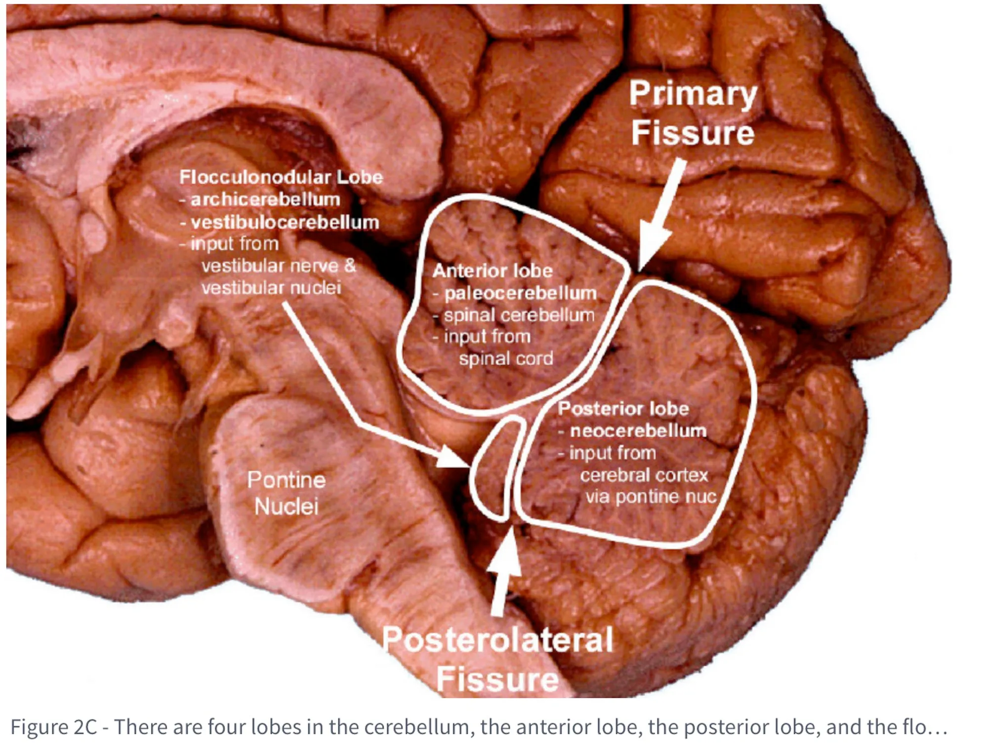 Sagittal section of the cerebellum labeling the anterior, posterior, and flocculonodular lobes